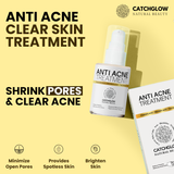 Anti Acne Treatment